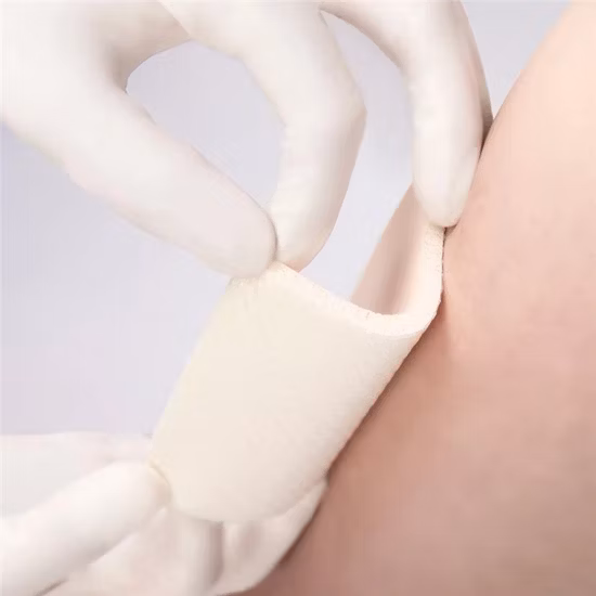 Adesivo in gel di silicone per medicazione in schiuma di silicone sterile per la cura di ferite da ustione o ulcere da pressione