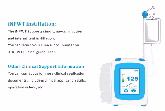 Medicatrice per kit schiuma Npwt per dispositivi medici